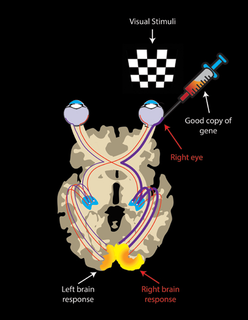 Illustration of the Brain under gene therapy
