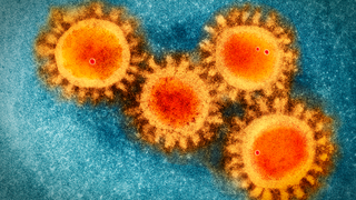 electron microscope image of the COVID-19 virus