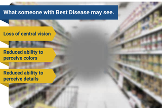 What someone with Best Disease may see: Loss of central vision; Reduced ability to perceive colors; Reduced ability to perceive details