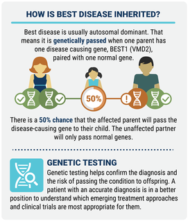 HOW IS BEST DISEASE INHERITED? Best disease is usually autosomal dominant. That means it is genetically passed when one parent has one disease causing gene, BEST1 (VMD2), paired with one normal gene. There is a 50% chance that the affected parent will pass the disease-causing gene to their child. The unaffected partner will only pass normal genes. Genetic testing helps confirm the diagnosis and the risk of passing the condition to offspring. A patient with an accurate diagnosis is in a better position to understand which emerging treatment approaches and clinical trials are most appropriate for them.
