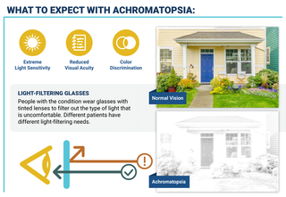 What to expect with Achromatopsia: Extreme Light Sensitivity; Reduced Visual Acuity; Color Discrimination. People with the condition wear glasses with tinted lenses to filter out the type of light that is uncomfortable. Different patients have different light-filtering needs.